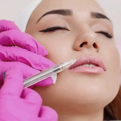 Dermal-Fillers
