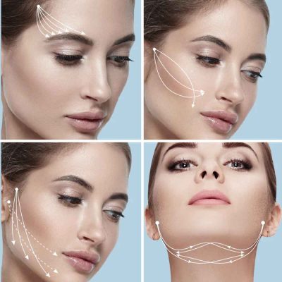 Thread-Lift